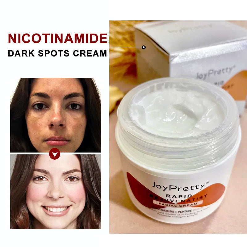 Niacinamide Dark Spots Remove Cream